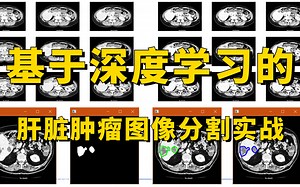 医学人工智能项目实战：基于深度学习的肝脏肿瘤图像分割实战教程，原理详解 项目实战，看完就能跑通！（计算机视觉/图像处理）