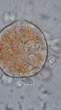 Suctorian Podophrya capturing a Didinium | microscopic predator and contractile vacuole