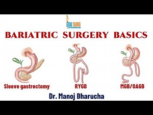 Bariatric surgery basics - Sleeve gastrectomy, mini-gastric bypass, RYGB - Weight loss mechanisms