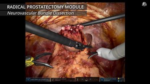 The only VR training simulator to provide a comprehensive curriculum including complete robotic clinical procedures with true-to-life graphics and tissue behavior – the RobotiX Mentor. https://bit.ly/35dDNWS #roboticsurgery #simulation #Simbionix #medicaled #VR #curriculum #surgicalsimulation #medicalsimulation | Surgical Science | Facebook