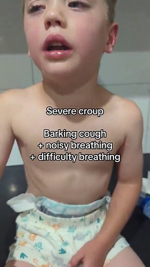 Understanding the Croup Cough: Sounds, Symptoms, and Severity