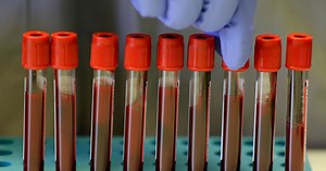 Covid-19: Ist die Blutgruppe ein Risikofaktor?