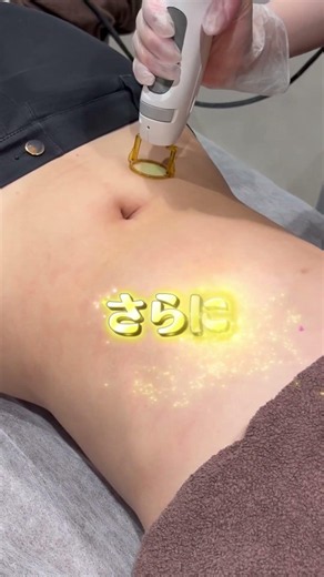#レナトゥスクリニック #医療脱毛 #ジェントルマックスプロプラス