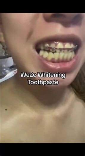 WE2C.toothpaste on TikTok