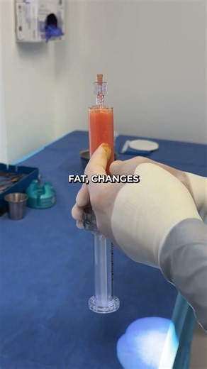 What fat grafting actually does