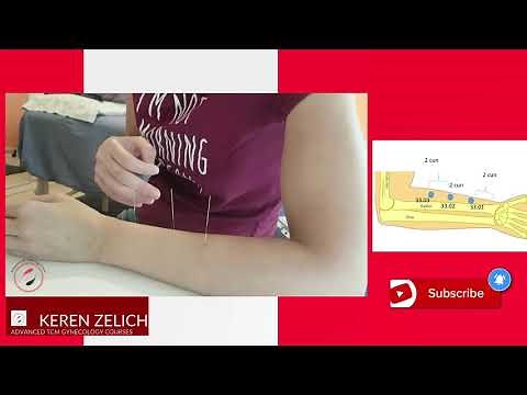 Master Tung's Acupuncture Points: 33.01 (Qi Men), 33.02 (Qi Jiao), 33.03 (Qi Zheng)