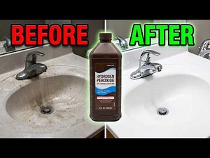 Hydrogen Peroxide Uses EVERYONE Needs To Know! 😱✨