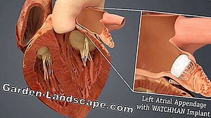 Tuinpraktijk: Auricle, Primula Auricula - Zorg & Voortplanting Van De Tuinoorschelp | 2025