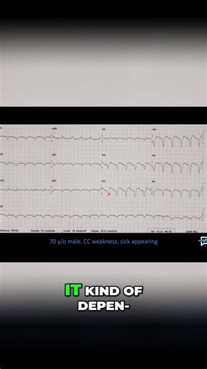 Unstable patient? Electrical cardioversion may be needed. Ventricular tachycardia could be life-threatening. Treat immediately! #Cardioversion #Ventriculartachycardia #MedicalEmergency #Healthcare