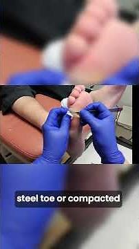 Hidden Wound Under a Callus? 😳 Foot Care Visit & Tough Work Boots