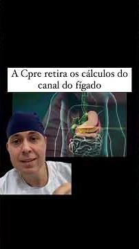 O que é CPRE?