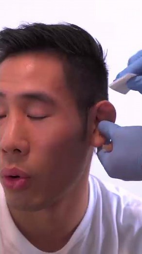 When your Friend Drains your Cauliflower Ear