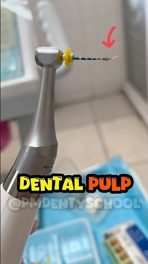 rotary file nerve removal | successful root canal therapy