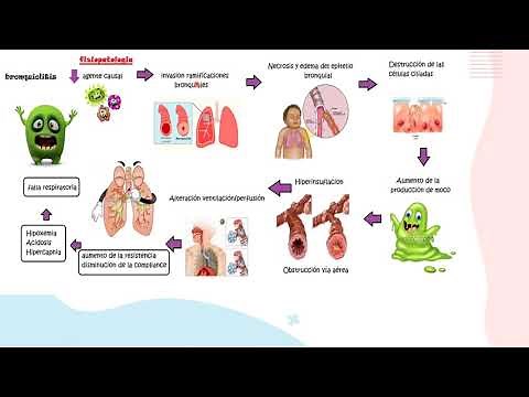 Bronquiolitis parte 1/Fisiopatología/Pediatría