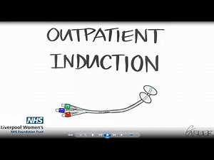 Induction of Labour - Out patient Induction