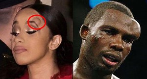 Dude Roasts Cardi B For Getting A Knot On Her Forehead After Fighting Nicki Minaj!