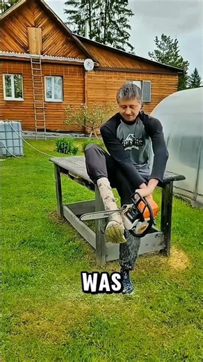 This DIY Prosthetic Cost Only $100