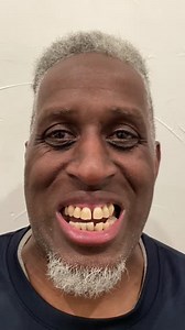 12 reactions | Say HELLO  to Nuvia's Permanent Teeth In 24 Hours! 醴 Comment below what you think of his new smile!! 朗 #maketheworldsmile #dentalimplants #dental #implants #transformation #dentures #teeth #dentistvlog #dentist #before #after #beforeandafter #positivelyunstoppable #health | Nuvia Dental Implant Center | Facebook