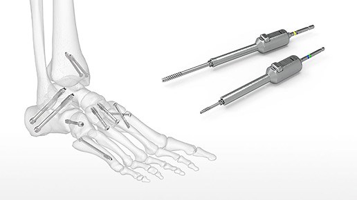OsteoMed ExtremiFix Cannulated Screw System - Midsize & Large