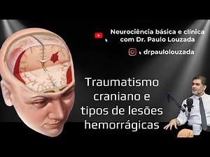 Traumatismo craniano e tipos de lesões hemorrágicas