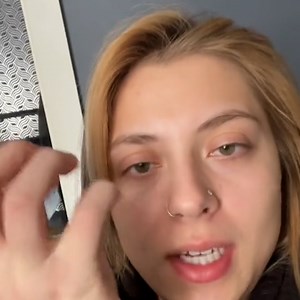 My employee almost lost his hand after a human bite - that didn't even break the skin 🤚 | Ultimate