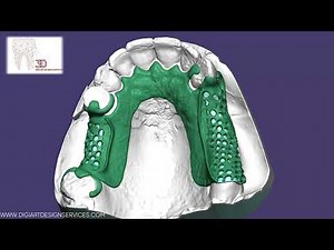 Perfect RPD Design with Innovative Solutions at DigiArt Design Services