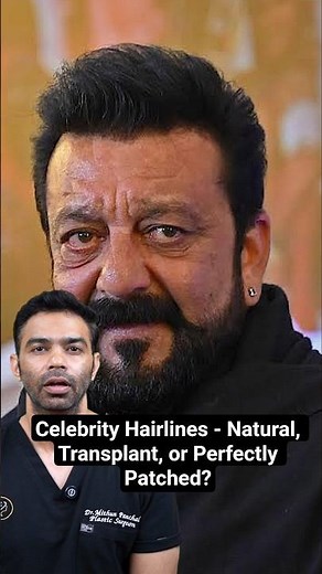 Celebrity Hairlines - Natural, Transplant, or Perfectly Patched?