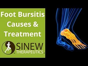 Foot Bursitis Causes and Treatment