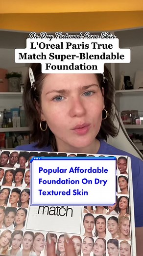 L'Oreal Paris True Match Super-Blendable Foundation Review for Dry Textured Acne Skin