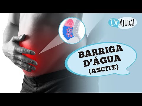 Ascites (or water belly): What it is, causes, diagnosis, and treatment.