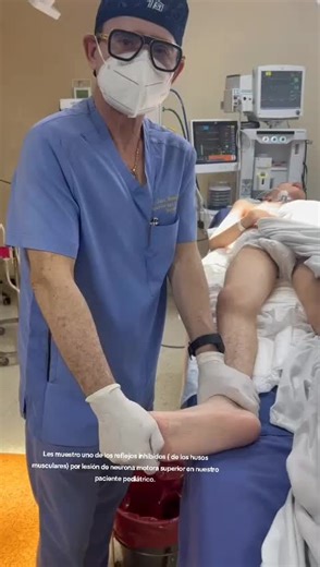 Les muestro uno de los reflejos inhibidos ( de los husos musculares) por lesión de neurona motora superior en nuestro paciente pediátrico. Tiene el mismo significado del signo Babinski. Cuando el signo ( Babinski) está presente en uno de mis pacientes de forma instantánea me recuerda la historia de los grandes Pasando visita Charcot, Babinski y Freud ( Padres de la Neurología Contemporánea y del Psicoanálisis) En el Hospital Salpetriere ( Paris) #recuperacion #cronico #neuro #cirugia #cerebral #