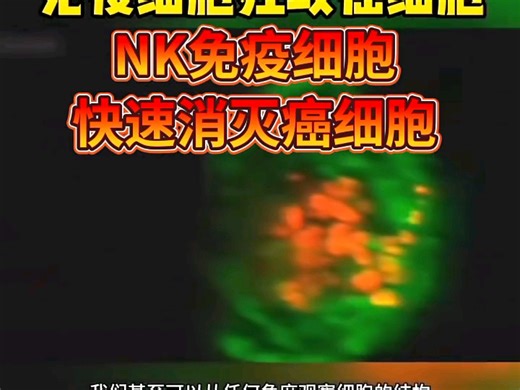 NK太厉害了，涨知识了