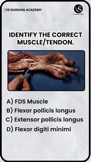 Can You Identify This Hand Muscle? | Nursing Anatomy Question #vsnursingacademy #norcet10