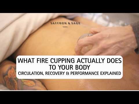 What Fire Cupping Actually Does to Your Body: Circulation, Recovery & Performance Explained