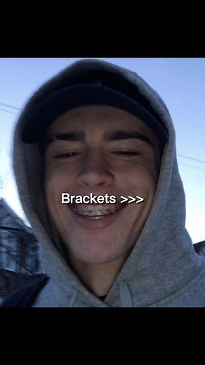 in my opinion that looks very attractive #brackets #edit #xyzbca #fyp #foryoupage