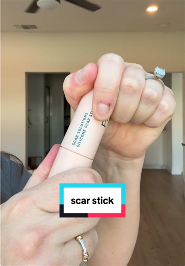 Effective Scar Healing with Daily Use of Scar Stick