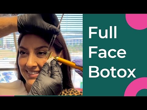 The Full Face Botox Treatment-The RJR Method