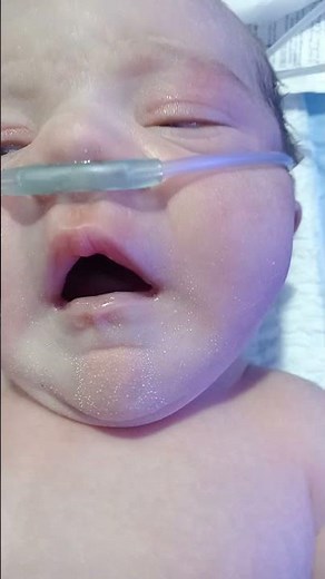 . Newborn Baby Birth Asphyxia | Oral Secretion Suction & Airway Clearance | NICU Nursing Care