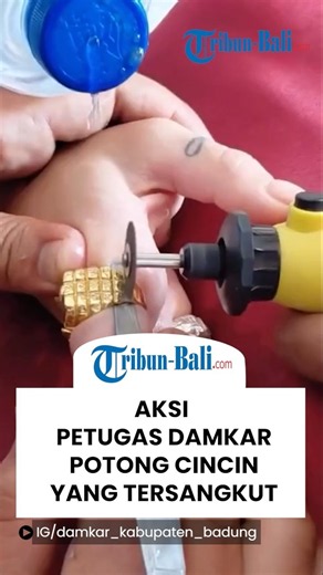 Aksi Petugas Pemadam Kebakaran Denpasar Potong Cincin yang Tersangkut