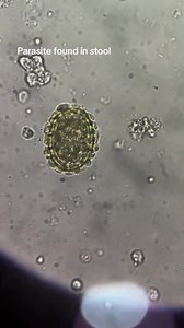 73K views · 682 reactions | Stool sample ❤️ | Lab life | Facebook