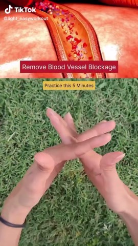 Improve blood vessels blockage and blood circulation in your body. Practice this yoga mudra daily for stronger blood circulation and a healthier heart ❤️ What Worries you most ? . . . [ yoga, yoga exercises, yoga for beginners, yoga exercise for blood circulation, Improve Blood Circulation, Remove Blood Vessel blockage, Detoxing the blood, blood circulation yoga] . . . #explorepage #yogateacher #yoga #yogainspiration