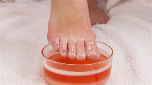 A Much Needed Pedicure to treat Peeling Skin