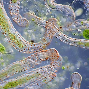 Aeolosoma worms are known as suction-feeding organisms because their mouths function a bit like a vacuum cleaner. When these animals find some food, they place their mouth over it and use tiny beating projections inside their mouths to create a vacuum, which sucks up the food. #MicroscopicMonday 🧫🔬by My Microscopic World | Science Channel