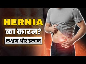 What is Hernia? 😧 Causes, Symptoms & Treatment Explained | Dr Sanjeev Kumar Gupta