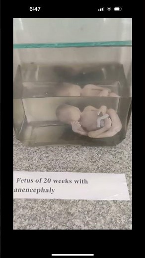 Live specimens are typically kept in solutions #pharmacareer #science