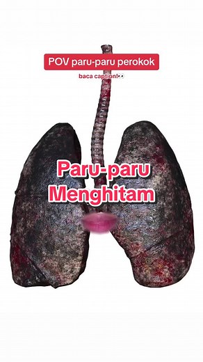 Bahaya Merokok: Penyakit Paru-paru dan Risikonya