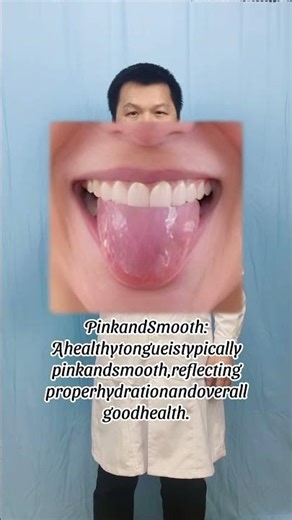 Your Tongue Color = Health Warning! (Doctor Explains) #shorts #tonguehealth #healthcheck #health