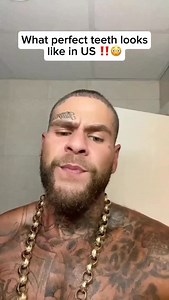 The miswak outperforms modern methods with natural antibacterial agents, that clean teeth, freshens breath, whitens naturally, and strengthens gums all without fluoride, plastic bristles, or harsh bleaching chemicals. It’s a time tested remedy that remains effective after thousands of years #cavities #toothbrush #teethwhitening | Healthy living