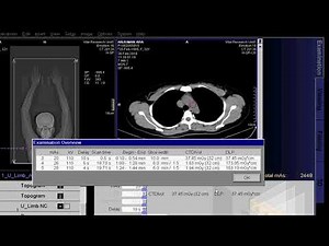 CT Scan Of Upper Limb Angio