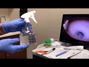 Copy of Colposcopy training video